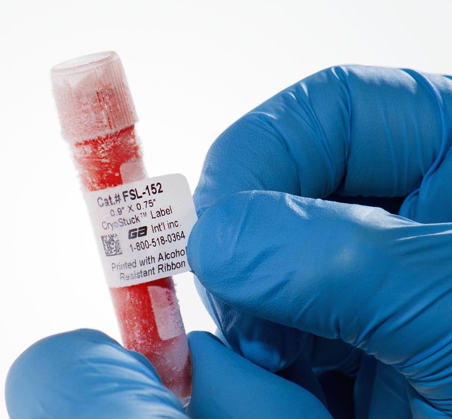 Kriyoprezervasyon Etiketleri